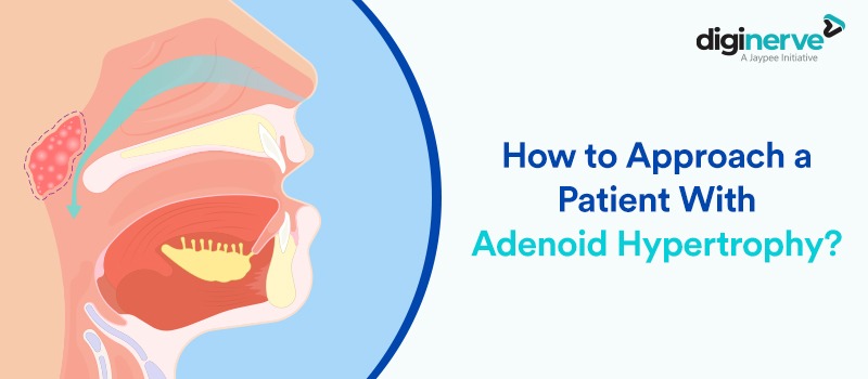 How to Approach a Patient With Adenoid Hypertrophy?